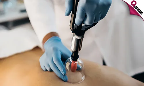 Cupping, Acupressure, Aromatherapy & More!